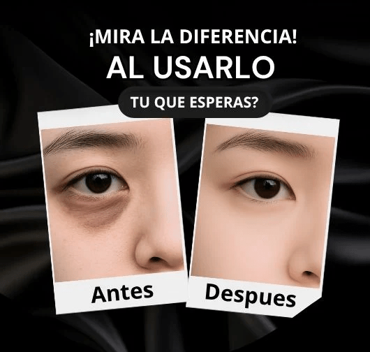Crema Anti Ojeras aclarador parpadosMiso - Imagen 4
