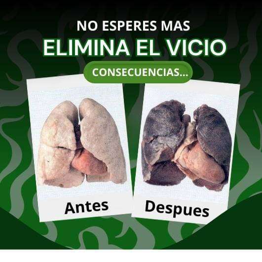 Pulmoclin Spray elimina habitos Natural - Imagen 2